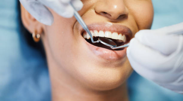 Best Emergency Denture Repair in Mattituck, NY